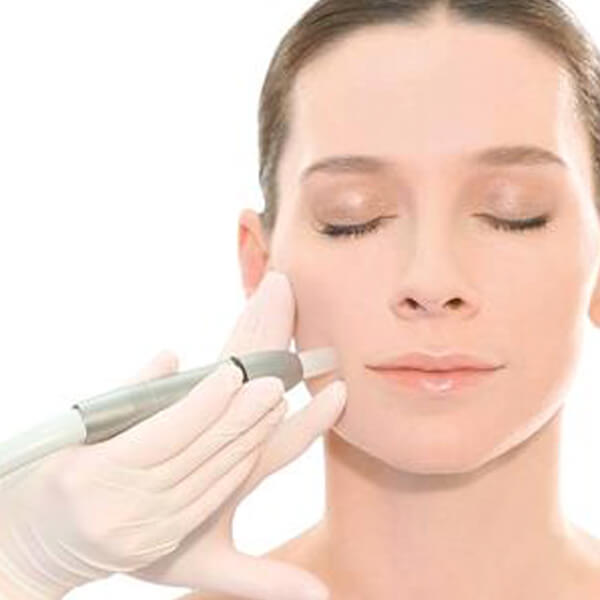 Featured Image for “Microdermabrasion”